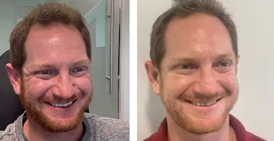 1656625685-b-f-5-ezgif.com-avif-to-jpg-converter