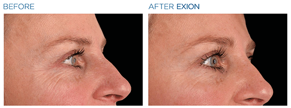 Exion_PIC_Ba-card-eyes-female-005_Face_ENUS100