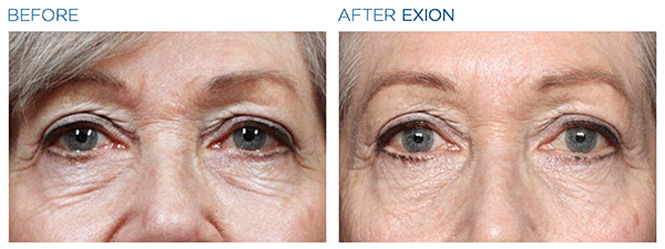 Exion_PIC_Ba-card-eyes-female-009_FRF_ENUS100