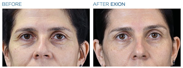 Exion_PIC_Ba-card-eyes-female-010_Face_ENUS100