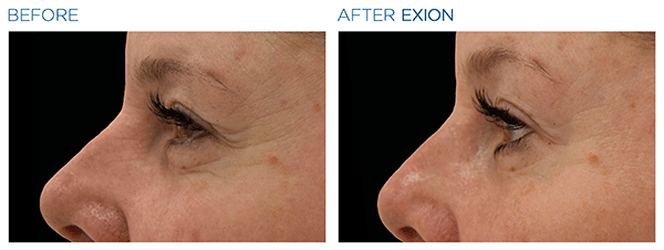 Exion_PIC_Ba-card-eyes-female-011_Face_ENUS100