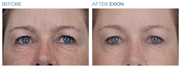 Exion_PIC_Ba-card-eyes-female-026_Face_ENUS100