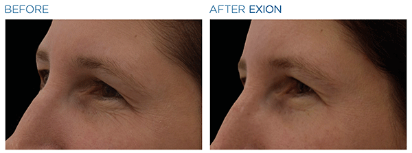 Exion_PIC_Ba-card-eyes-female-027_Face_ENUS100