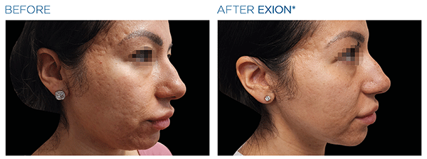 Exion_PIC_Ba-card-face-female-071_FRF_ENUS100