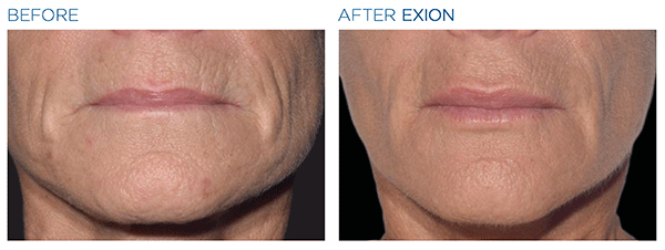 Exion_PIC_Ba-card-mouth-female-066_FRF_ENUS100