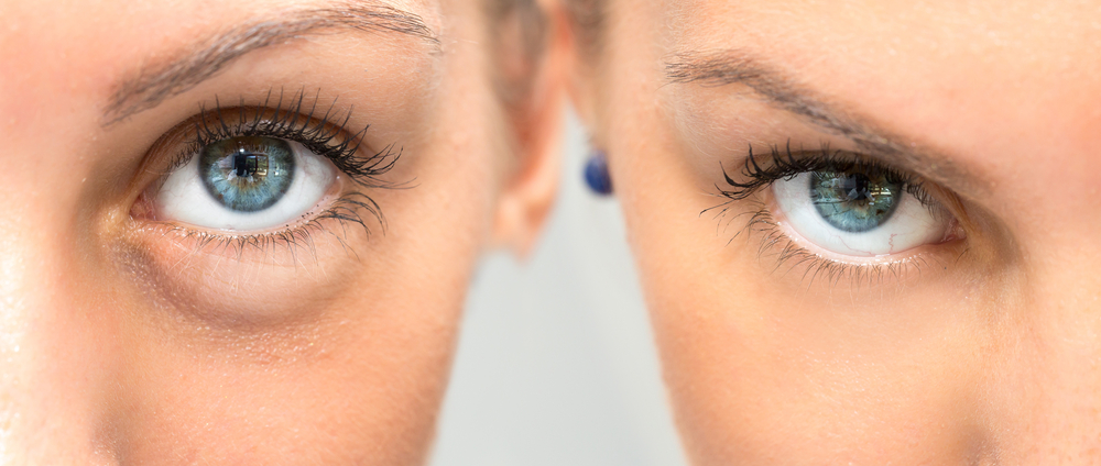 EYES