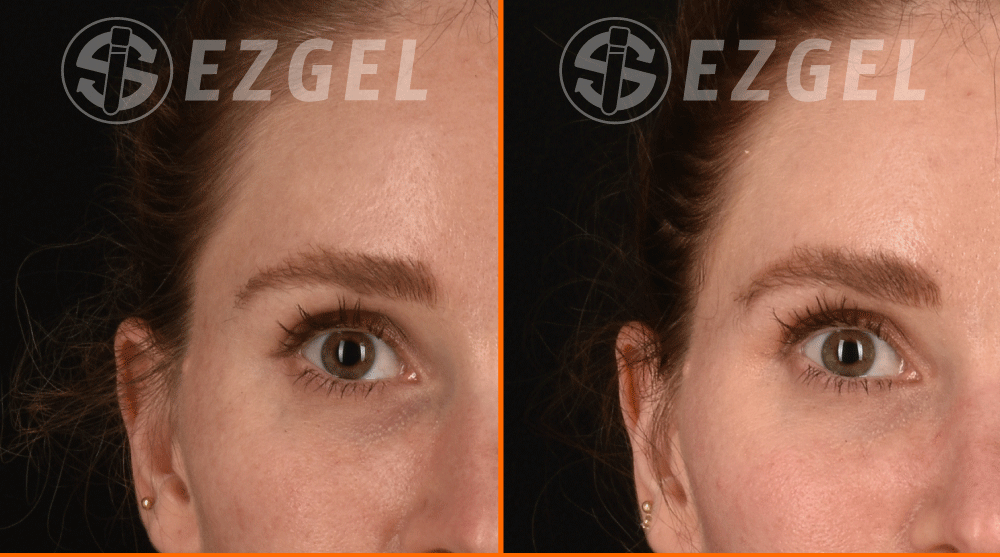 ezgel-5