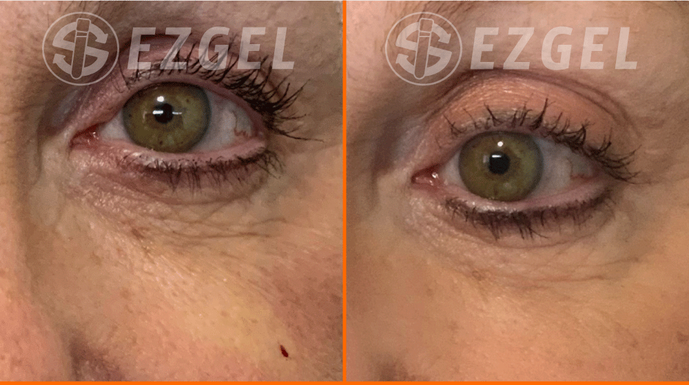 ezgel-8